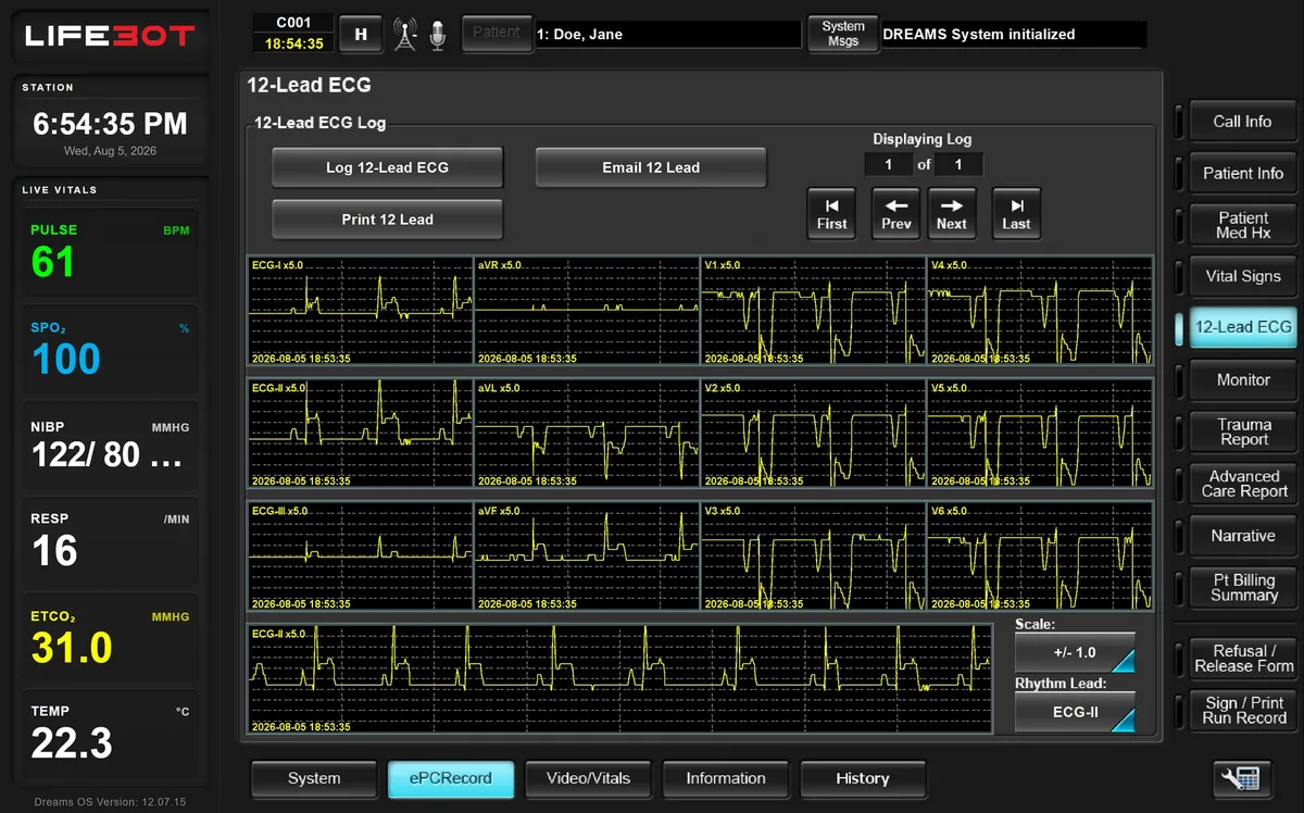 12 derivasyonlu EKG inceleme çalışma alanı